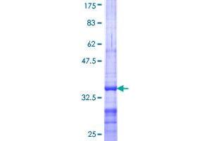 ATP-Binding Cassette, Sub-Family A (ABC1), Member 10 (ABCA10) (AA 1-80) protein (GST tag)