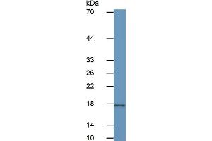 Mouse Capture antibody from the kit in WB with Positive Control: Human Stomach lysate. (IL-2 ELISA Kit)