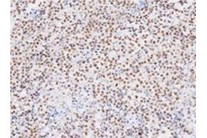 Immunohistochemistry (IHC) image for anti-TAR DNA Binding Protein (TARDBP) (AA 1-260), (N-Term) antibody (ABIN317572) (TARDBP antibody  (N-Term))