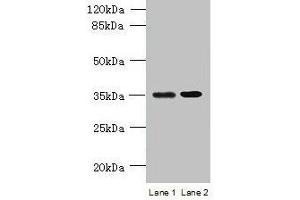 Western blot All lanes: CFAP65 antibody at 8 μg/mL Lane 1: U251 whole cell lysate Lane 2: U87 whole cell lysate Secondary Goat polyclonal to rabbit IgG at 1/10000 dilution Predicted band size: 218, 19, 82, 88 kDa Observed band size: 35 kDa (CCDC108 antibody  (AA 2-164))