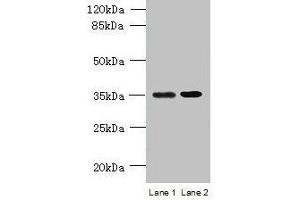 Western blot All lanes: CFAP65 antibody at 8 μg/mL Lane 1: U251 whole cell lysate Lane 2: U87 whole cell lysate Secondary Goat polyclonal to rabbit IgG at 1/10000 dilution Predicted band size: 218, 19, 82, 88 kDa Observed band size: 35 kDa (CCDC108 antibody  (AA 2-164))