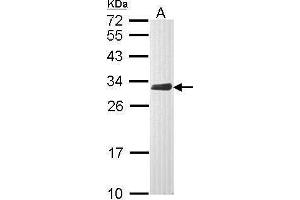WB Image Sample (30 ug of whole cell lysate) A: Raji 12% SDS PAGE antibody diluted at 1:1000 (CLIC4 antibody)