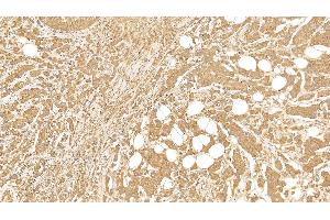 Immunohistochemistry (IHC) image for anti-Keratin 18 (KRT18) (AA 238-396) antibody (ABIN7426868)