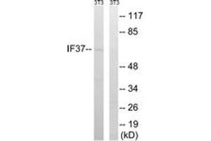 Western blot analysis of extracts from NIH-3T3 cells, using EIF3D Antibody.
