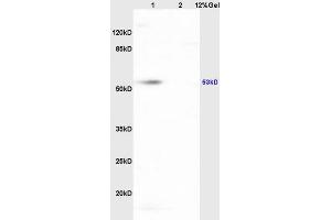 Lane 1: mouse heart lysates Lane 2: mouse brain lysates probed with Anti HCLS1/LckBP1 Polyclonal Antibody, Unconjugated (ABIN709811) at 1:200 in 4 °C.