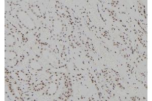 ABIN6273566 at 1/100 staining Human kidney tissue by IHC-P.