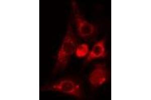 ABIN6275051 staining Hela cells by IF/ICC. (PLA2G4C antibody  (Internal Region))