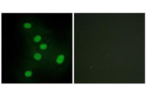 Immunofluorescence analysis of HepG2 cells, using NR2F6 antibody.