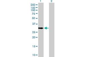 Western Blot analysis of ECHDC1 expression in transfected 293T cell line by ECHDC1 MaxPab polyclonal antibody.