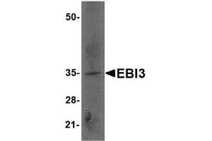 Image no. 2 for anti-Interleukin-27 subunit beta (IL-27b) (Internal Region) antibody (ABIN341721) (EBI3 antibody  (Internal Region))