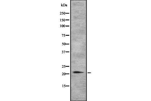 TGIF2LY antibody