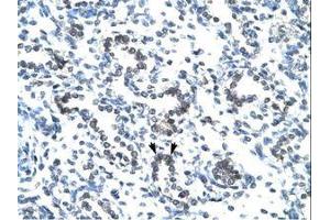 Image no. 1 for anti-EVX1 (EVX1) (AA 74-123) antibody (ABIN202451) (EVX1 antibody  (AA 74-123))