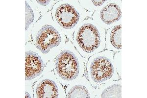 IHC analysis of CDK1 using anti-CDK1 antibody (ABIN7602240). (CDK1 antibody  (AA 66-297))