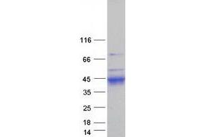 Validation with Western Blot (Kallikrein 11 Protein (KLK11) (Transcript Variant 1) (Myc-DYKDDDDK Tag))
