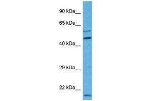 Host:  Rabbit  Target Name:  MBOAT1  Sample Tissue:  Human 786-0 Whole Cell  Antibody Dilution:  1ug/ml (MBOAT1 antibody  (N-Term))
