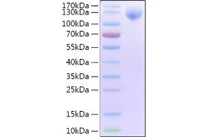 Recombinant 2019-nCoV Spike S1 Protein with His and Avi tag on Tris-Bis PAGE under reduced condition. (SARS-CoV-2 Spike S1 Protein (His-Avi Tag))