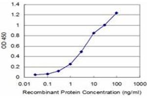 Detection limit for recombinant GST tagged NEK2 is approximately 0. (NEK2 antibody  (AA 331-445))