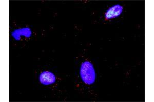 Proximity Ligation Analysis of protein-protein interactions between PARD3 and CTNNB1. (PARD3 antibody  (AA 1-1340))