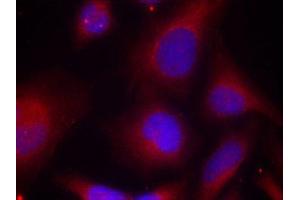 Immunofluorescence staining of methanol-fixed Hela cells using Phospho-MARCKS-S158 antibody.