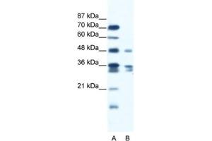 Western Blotting (WB) image for anti-Zinc Finger Protein 577 (ZNF577) antibody (ABIN2461281) (ZNF577 antibody)