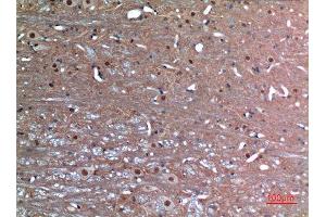 Immunohistochemistry (IHC) analysis of paraffin-embedded Rat Brain, antibody was diluted at 1:100. (Latexin antibody  (Internal Region))