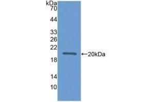 Detection of Recombinant APOL2, Human using Polyclonal Antibody to Apolipoprotein L2 (APOL2) (Apolipoprotein L 2 antibody  (AA 186-337))