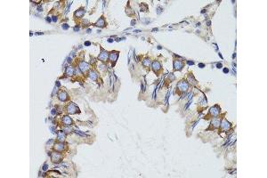 Immunohistochemistry of paraffin-embedded Mouse testis using HEXA Polyclonal Antibody at dilution of 1:100 (40x lens). (Hexosaminidase A antibody)