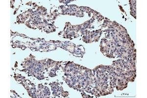 IHC analysis of Neurofibromin/NF1 using anti-Neurofibromin/NF1 antibody (ABIN7600196). (Neurofibromin 1 antibody  (AA 160-270))