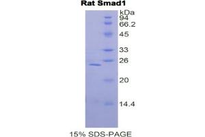 SDS-PAGE analysis of Rat Smad1 Protein.