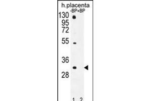 Western blot analysis of OR1D5 Antibody (C-term) Pab (ABIN655952 and ABIN2845338) pre-incubated without(lane 1) and with(lane 2) blocking peptide in human placenta tissue lysate. (OR1D5 antibody  (C-Term))