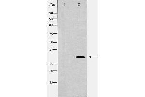 Western blot analysis of HEX293  lysate using CDCA8 antibody. (CDCA8 antibody)