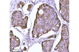 IHC analysis of CTNND1 using anti-CTNND1 antibody (ABIN7602220). (CTNND1 antibody  (AA 64-930))