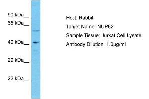 Host: Rabbit Target Name: NUP62 Sample Type: Jurkat Whole Cell lysates Antibody Dilution: 1. (NUP62 antibody  (Middle Region))