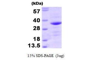 Figure annotation denotes ug of protein loaded and % gel used. (BAG1 Protein (AA 1-230))