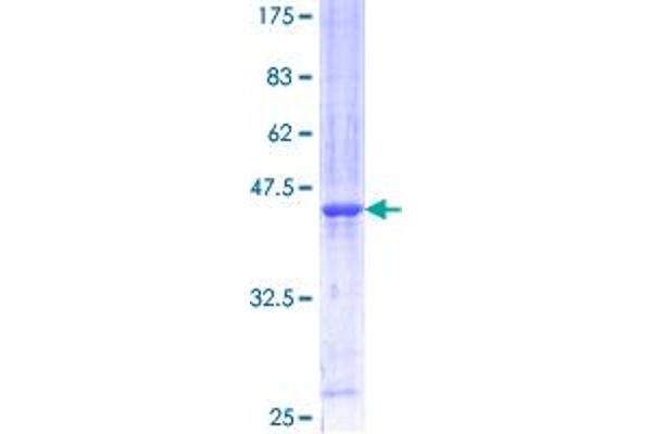 BUD31 Protein (AA 1-144) (GST tag)