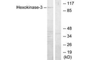 Western blot analysis of extracts from Jurkat cells, treated with insulin 0. (HK3 antibody  (AA 811-860))