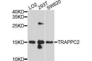 Western blot analysis of extracts of various cell lines, using TRAPPC2 antibody (ABIN5999090) at 1/1000 dilution.