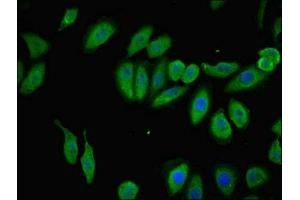 Immunofluorescent analysis of A549 cells using ABIN7173039 at dilution of 1:100 and Alexa Fluor 488-congugated AffiniPure Goat Anti-Rabbit IgG(H+L) (TMEM120B antibody  (AA 1-101))