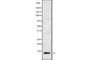 Western blot analysis IFI6 using HeLa whole cell lysates (IFI6 antibody)