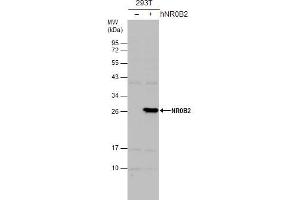 WB Image Non-transfected (–) and transfected (+) 293T whole cell extracts (30 μg) were separated by 12% SDS-PAGE, and the membrane was blotted with NR0B2 antibody [N2C3] , diluted at 1:500. (NR0B2 antibody)