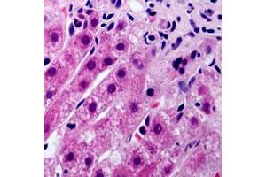 Immunohistochemical analysis of Cytochrome P450 21A2 staining in human liver formalin fixed paraffin embedded tissue section. (CYP21A2 antibody  (Center))