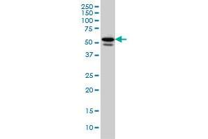 TBL1XR1 monoclonal antibody (M01), clone 3G7 Western Blot analysis of TBL1XR1 expression in HeLa . (TBL1XR1 antibody  (AA 81-178))