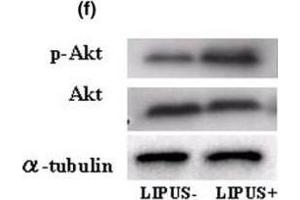 Western Blotting (WB) image for anti-V-Akt Murine Thymoma Viral Oncogene Homolog 1 (AKT1) (C-Term) antibody (ABIN94783)