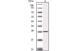 Western blot analysis using IKBKB mouse mAb against truncated IKBKB recombinant protein (1).