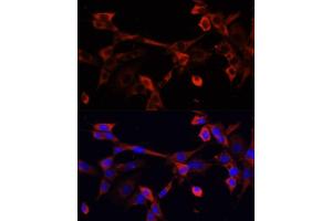 Immunofluorescence analysis of NIH/3T3 cells using DNL1 antibody (ABIN6130967, ABIN6139736, ABIN6139738 and ABIN6217037) at dilution of 1:100. (DNASEX antibody  (AA 1-302))
