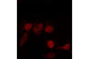 ABIN6276040 staining LOVO by IF/ICC. (GPR87 antibody  (Internal Region))