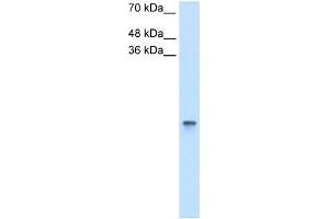 RBP1 antibody used at 2. (RBP1 antibody  (Middle Region))
