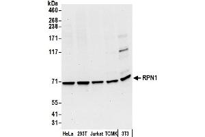 Western Blotting (WB) image for anti-Ribophorin 1 (RPN1) (AA 1-50) antibody (ABIN7453197)