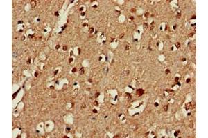Immunohistochemistry of paraffin-embedded human brain tissue using ABIN7147395 at dilution of 1:100 (C3orf34 antibody  (AA 1-163))
