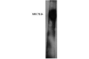 Image no. 1 for anti-Lipid Phosphate Phosphatase-Related Protein Type 3 (LPPR3) antibody (ABIN4620343) (LPPR3 antibody)